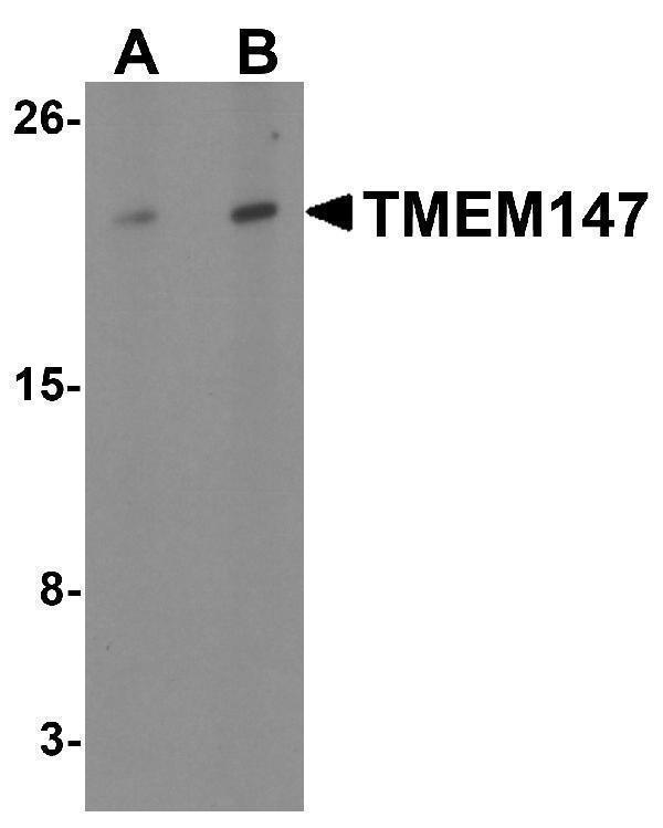 a15293 tmem147 primary antibodies wb testing 1
