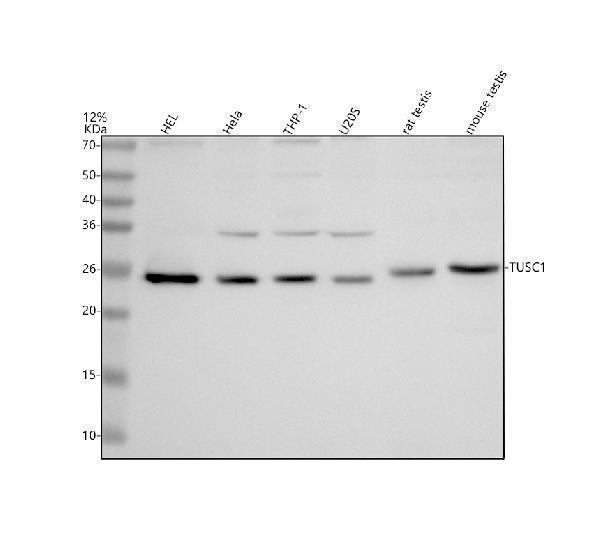 a15296 1 tusc1 primary antibodies wb testing 1