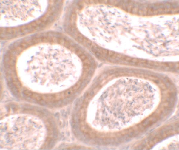 a15298 mospd1 primary antibodies ihc testing 2