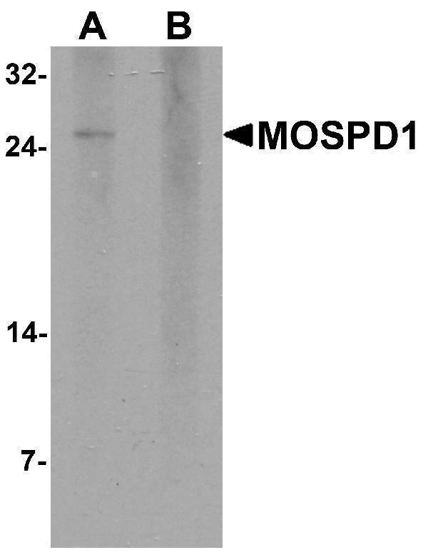 a15298 mospd1 primary antibodies wb testing 1