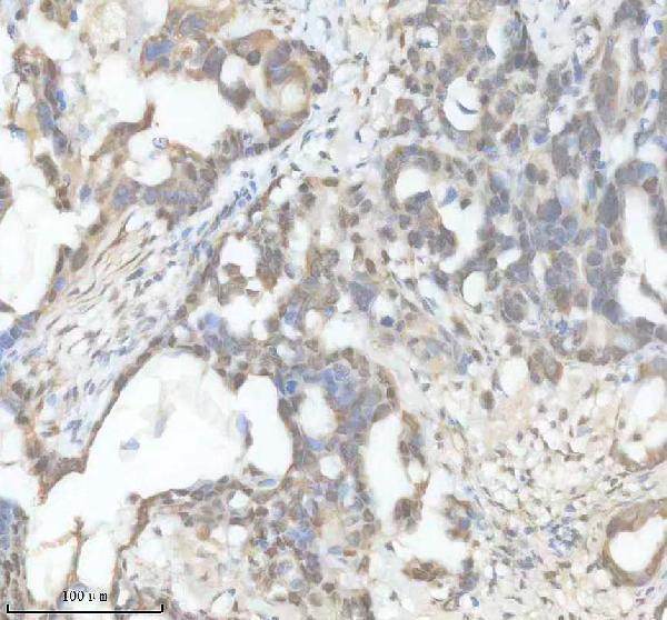 a15301 2 ccdc12 primary antibodies ihc testing 1