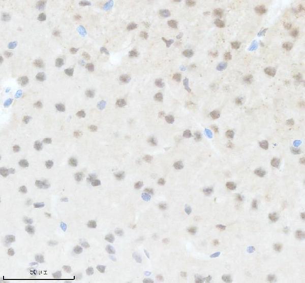 a15301 2 ccdc12 primary antibodies ihc testing 2