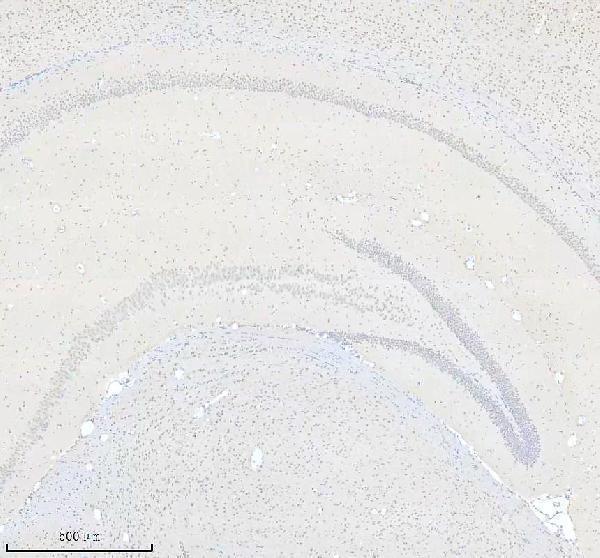 a15301 2 ccdc12 primary antibodies ihc testing 3