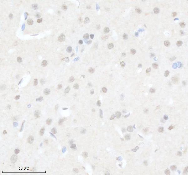 a15301 2 ccdc12 primary antibodies ihc testing 4
