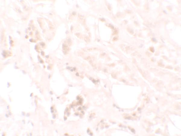 a15307 kank3 primary antibodies ihc testing 2