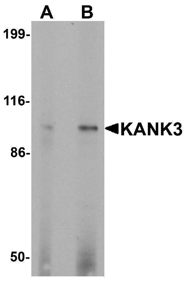 a15307 kank3 primary antibodies wb testing 1