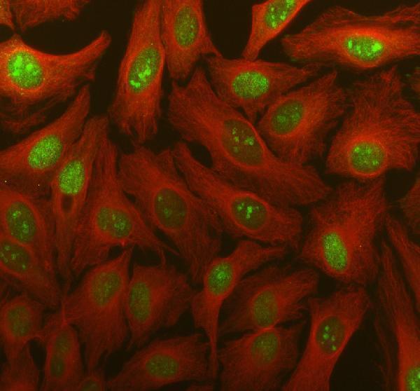 IF analysis of TDG using anti-TDG antibody (A15317-1) and anti-Tubulin Alpha antibody (M03989-3)