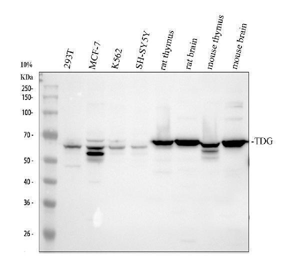 Western blot analysis of TDG using anti-TDG antibody (A15317-1)