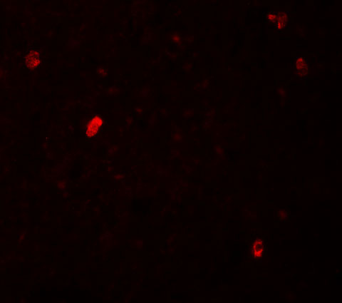 a15331 fbxl16 primary antibodies if testing 3