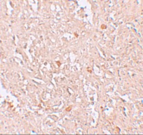 a15331 fbxl16 primary antibodies ihc testing 2