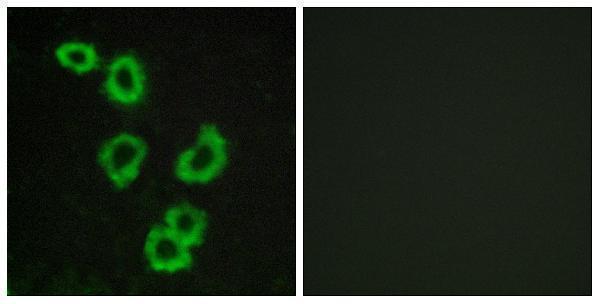 a15335 gpr176 primary antibodies if testing 1