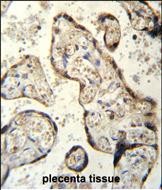 a15336 anti rsbn1 antibody n term ihc p testing 4