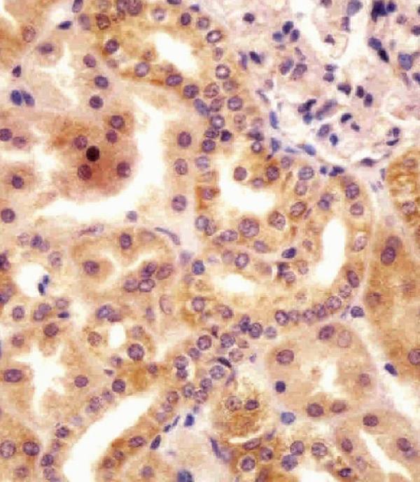 a15336 anti rsbn1 antibody n term ihc p testing 5