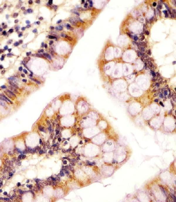 a15336 anti rsbn1 antibody n term ihc p testing 6
