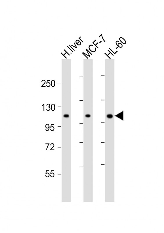 a15336 anti rsbn1 antibody n term wb testing 1