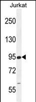 a15336 anti rsbn1 antibody n term wb testing 2