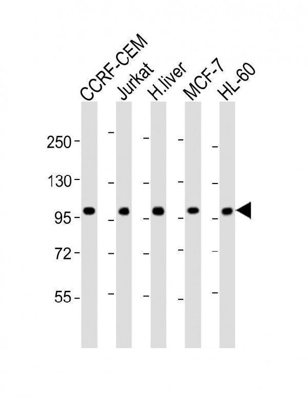 a15336 anti rsbn1 antibody n term wb testing 3