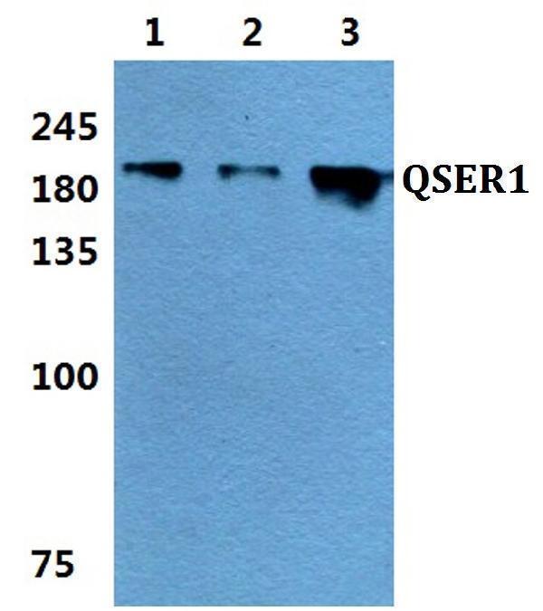a15337 qser1 primary antiboties wb testing 1