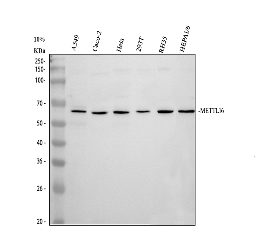 Western blot analysis of METTL16 using anti-METTL16 antibody (A15345-1)