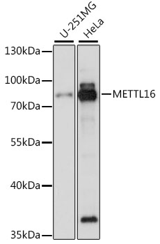 Western blot analysis of extracts of various cell lines, using METTL16 antibody