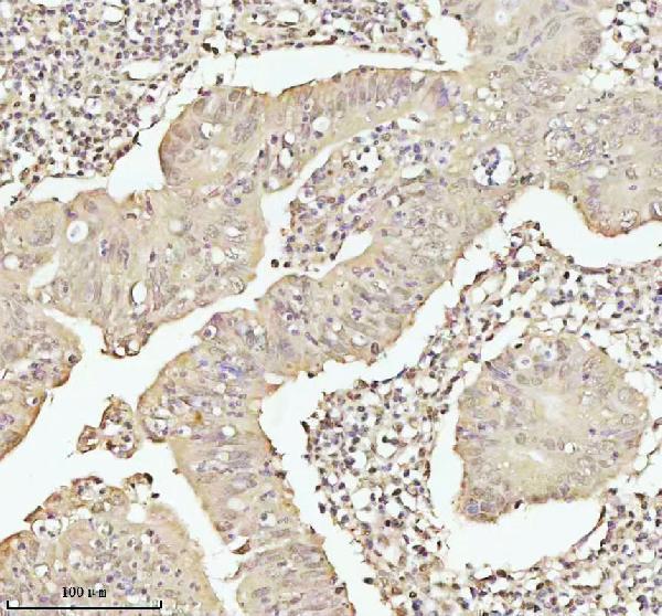 a15347 1 pithd primary antibodies ihc testing 11