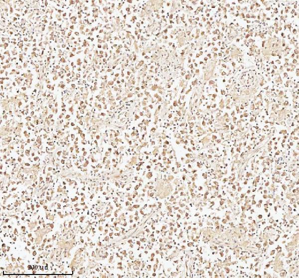 a15347 1 pithd primary antibodies ihc testing 12