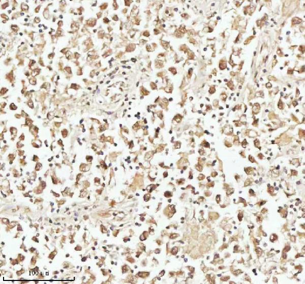 a15347 1 pithd primary antibodies ihc testing 13