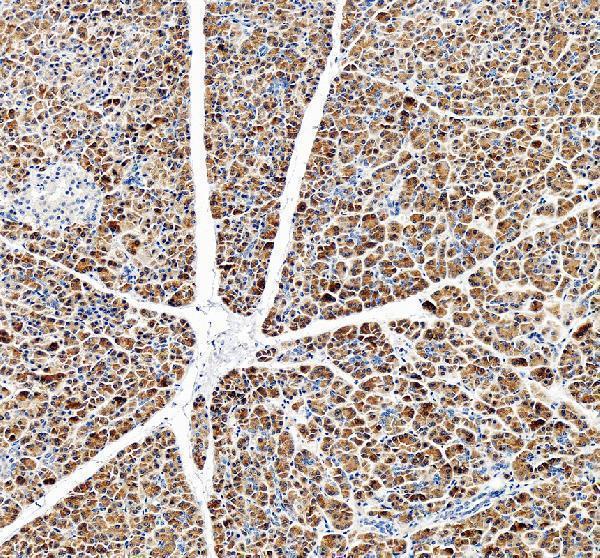 IHC analysis of OGFOD3 using anti-OGFOD3 antibody (A15361-1)