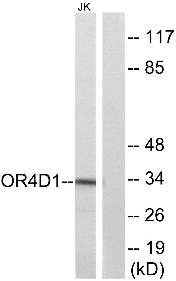 Western blot analysis of lysates from Jurkat cells, using OR4D1 Antibody