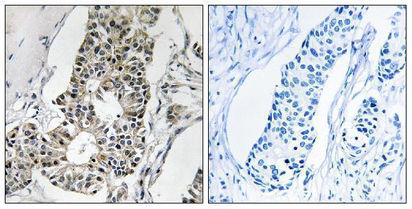 a15404 1 rims4 primary antibodies ihc testing 1