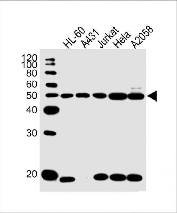 All lanes : Anti-KRT28 Antibody (C-term) at 1:1000 dilutionLane 1: HL-60 whole cell lysateLane 2: A431 whole cell lysateLane 3: Jurkat whole cell lysateLane 4: Hela whole cell lysateLane 5: A2058 whole cell lysateLysates/proteins at 20 µg per lane