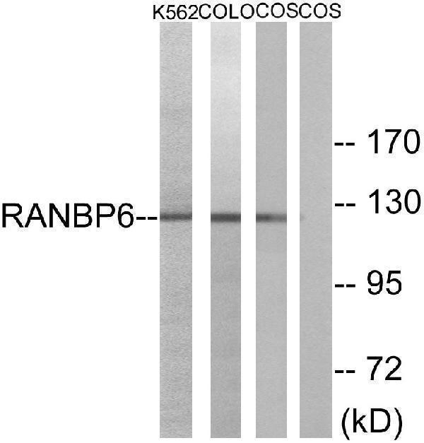 Western blot analysis of lysates from COS7, K562, and COLO cells, using RANBP6 Antibody