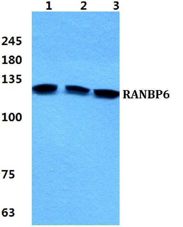 a15427 2 ranbp6 primary antiboties wb testing 1
