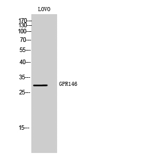 Western Blot analysis of LOVO cells using GPR146 Polyclonal Antibody