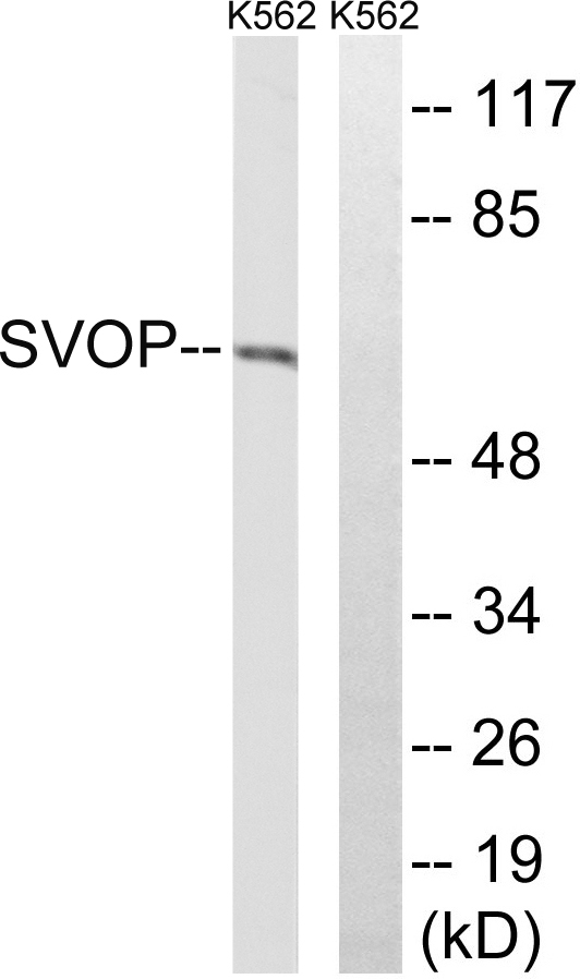 Western blot analysis of lysates from K562 cells, using SVOP Antibody