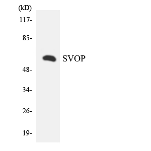 Western blot analysis of the lysates from Jurkat cells using SVOP antibody