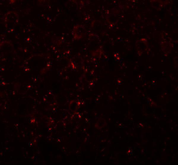 a15486 ccdc141 primary antibodies if testing 3