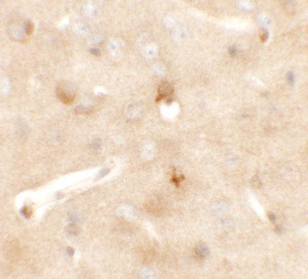 a15486 ccdc141 primary antibodies ihc testing 2