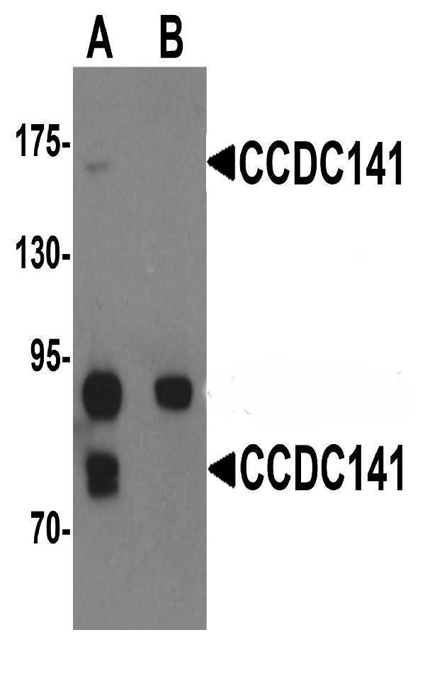 a15486 ccdc141 primary antibodies wb testing 1
