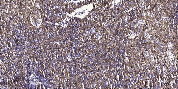 Immunohistochemical analysis of paraffin-embedded human spleen tissue