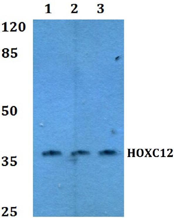 Western blot (WB) analysis of HOX-C12 polyclonal antibody at 1:500 dilution
Lane1:MCF-7 whole cell lysate
Lane2:NIH-3T3 whole cell lysate
Lane3:PC12 whole cell lysate