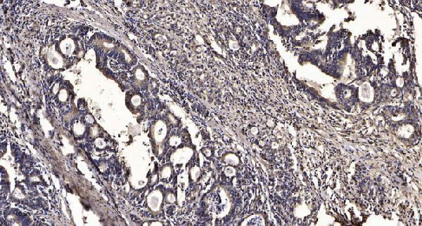 a15493 nbeal1 primary antibodies ihc testing 1