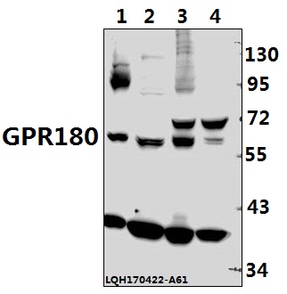 a15497 1 gpr180 primary antiboties wb testing 1