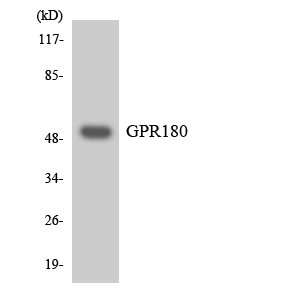Western blot analysis of the lysates from Jurkat cells using GPR180 antibody