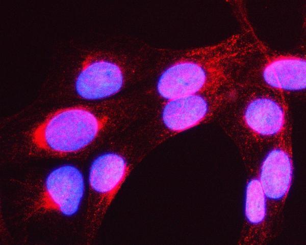 a15498 myh16 primary antibodies if testing 2