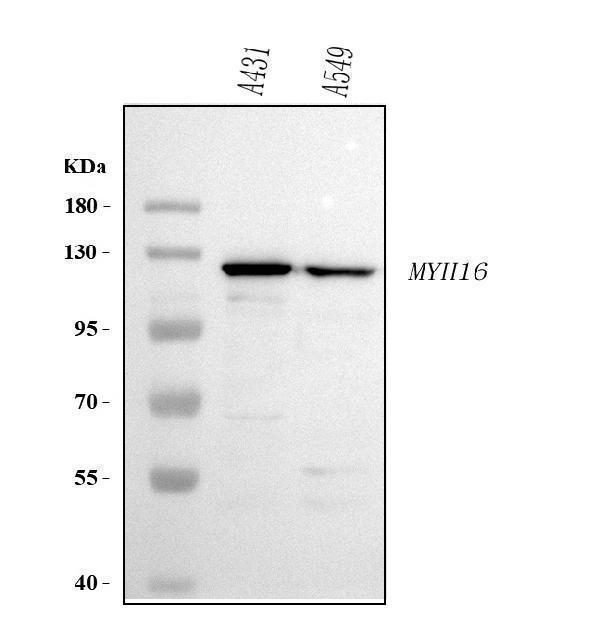 a15498 myh16 primary antibodies wb testing 1