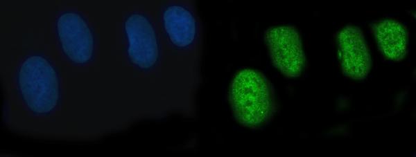 Figure 2. IF analysis of POGLUT3 using anti-POGLUT3 antibody (A15507-1). POGLUT3 was detected in an immunocytochemical section of U20S cells. Enzyme antigen retrieval was performed using IHC enzyme antigen retrieval reagent (AR0022) for 15 mins. The cells were blocked with 10% goat serum. And then incubated with 5 microg/mL rabbit anti-POGLUT3 Antibody (A15507-1) overnight at 4°C. DyLight®488 Conjugated Goat Anti-Rabbit IgG (BA1127) was used as secondary antibody at 1:100 dilution and incubated for 30 minutes at 37°C. The section was counterstained with DAPI. Visualize using a fluorescence microscope and filter sets appropriate for the label used. Figure 2. IF analysis of POGLUT3 using anti-POGLUT3 antibody (A15507-1). POGLUT3 was detected in an immunocytochemical section of U20S cells. Enzyme antigen retrieval was performed using IHC enzyme antigen retrieval reagent (AR0022) for 15 mins. The cells were blocked with 10% goat serum. And then incubated with 5 microg/mL rabbit anti-POGLUT3 Antibody (A15507-1) overnight at 4°C. DyLight®488 Conjugated Goat Anti-Rabbit IgG (BA1127) was used as secondary antibody at 1:100 dilution and incubated for 30 minutes at 37°C. The section was counterstained with DAPI. Visualize using a fluorescence microscope and filter sets appropriate for the label used.