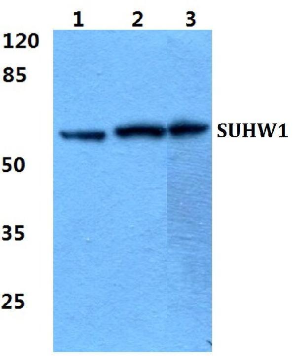 a15519 1 znf280a primary antiboties wb testing 1
