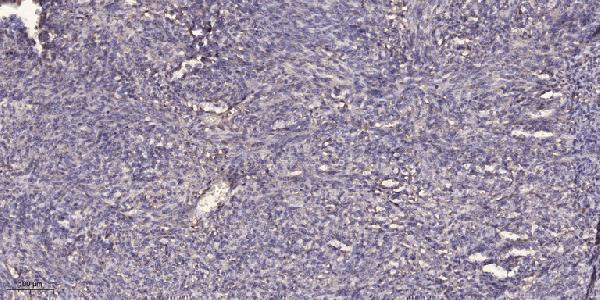 a15519 znf280a primary antibodies ihc testing 1