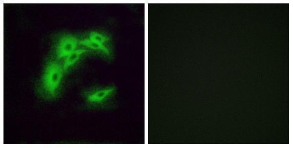 a15527 or5i1 primary antibodies if testing 1